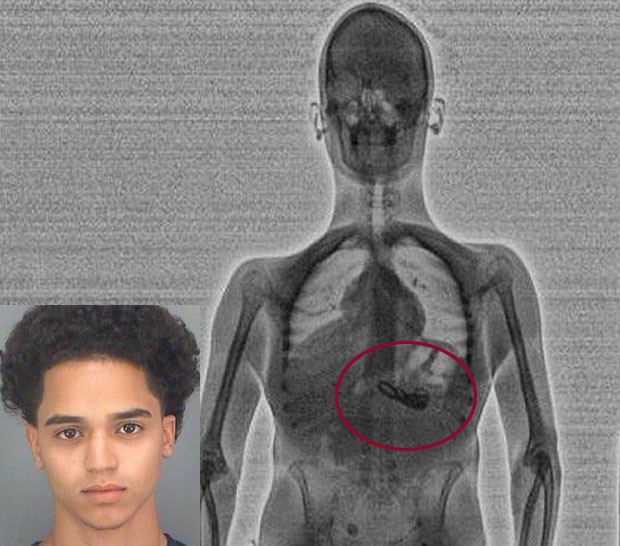 Scanner corporal revelou que preso havia engolido colares roubados (Foto: Divulgação/Pinellas County Jail
